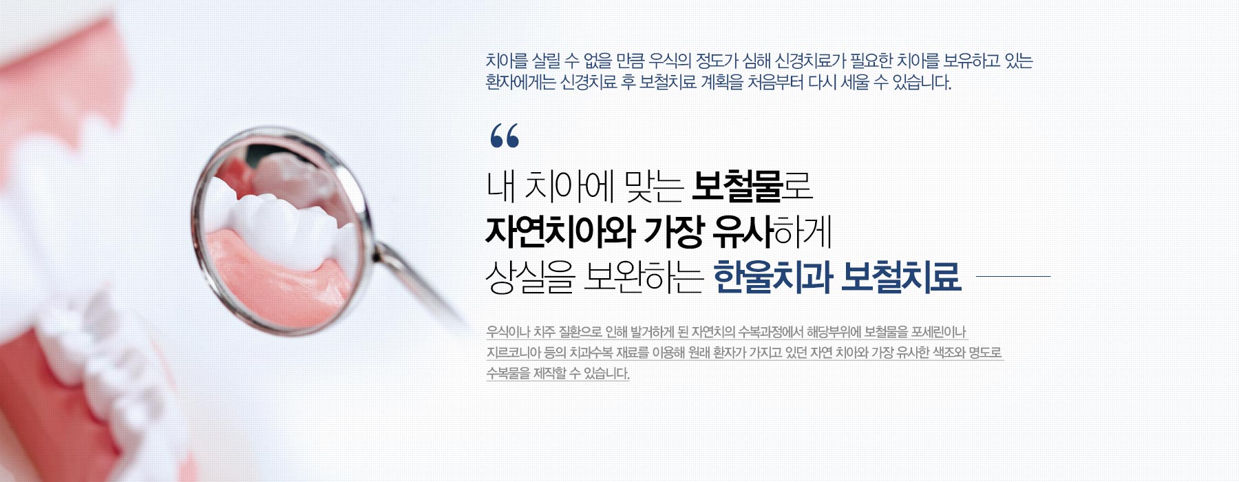내 치아에 맞는 보철물로 자연치아와 가장 유사하게 상실을 보완하는 한울치과 보철치료