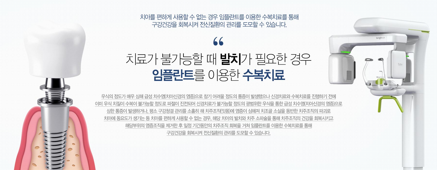치료가 불가능할 때 발치가 필요한 경우